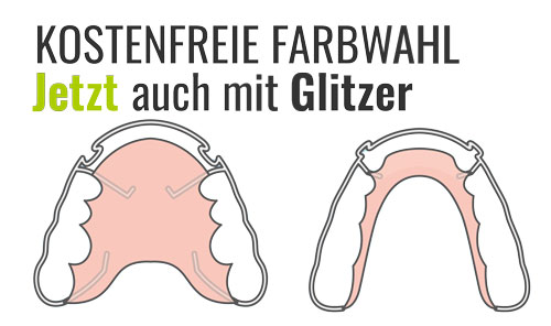 Eine Illustration einer losen Spange